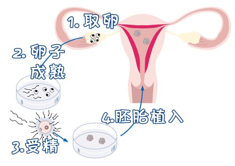 男性因素